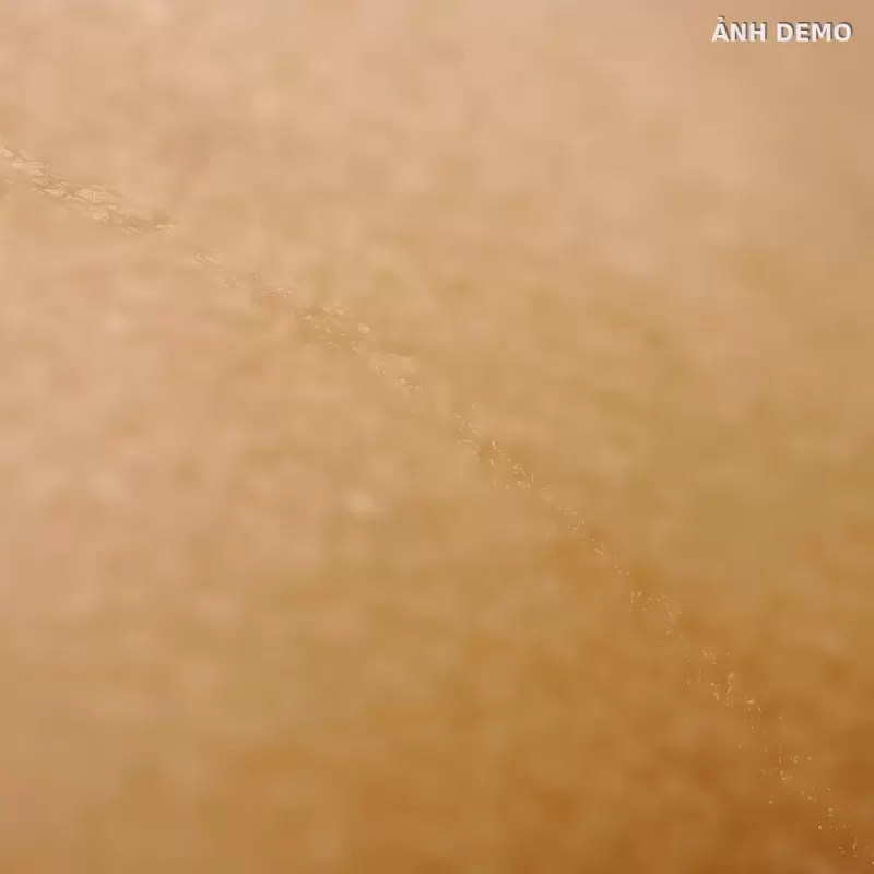 Sau 5 buổi — Lỗ chân lông to do tiết dầu — peel định kỳ (ảnh minh hoạ demo)