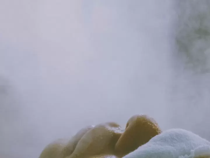 HIFU và RF vi điểm: khác nhau ở đâu, ai phù hợp? — ảnh minh họa