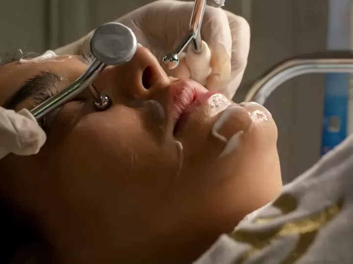 Laser toning điều trị nám tại phòng khám (ảnh minh họa)