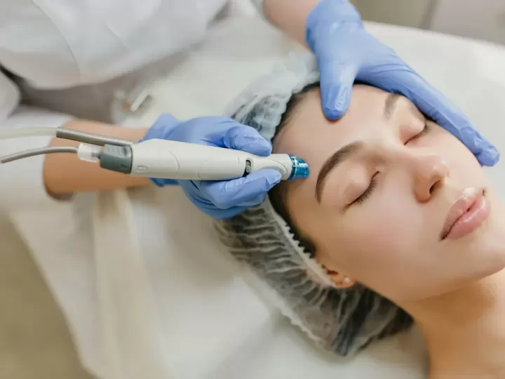 Laser Fractional CO2 điều trị sẹo rỗ tại phòng khám (ảnh minh họa)