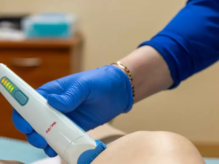 RF vi điểm (Microneedling RF) tại phòng khám (ảnh minh họa)