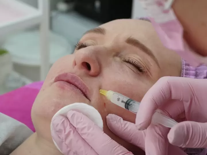 Tiêm filler HA tạo đường nét tại phòng khám (ảnh minh họa)