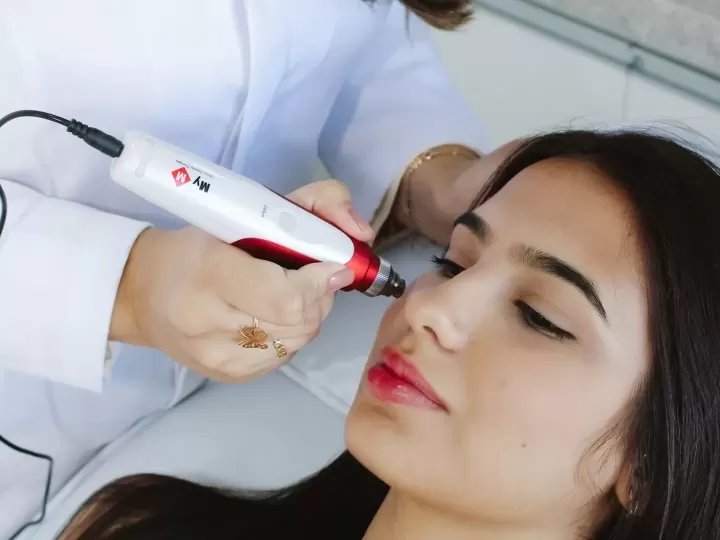 Laser trị thâm sau mụn tại phòng khám (ảnh minh họa)