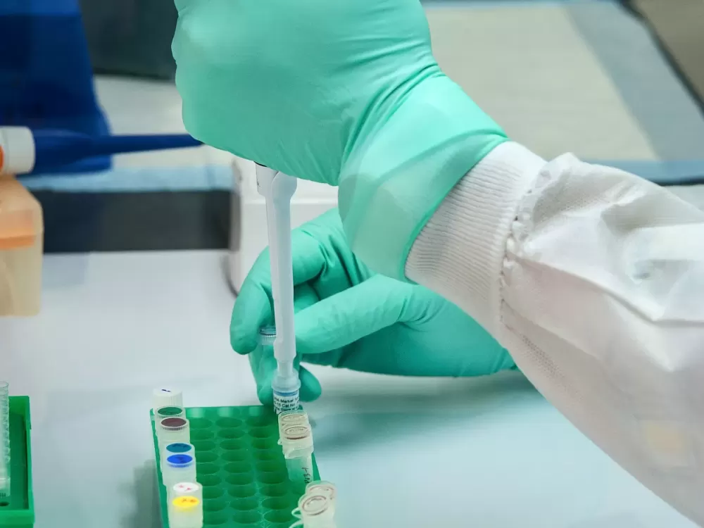 Pipet nhỏ dung dịch vào lọ