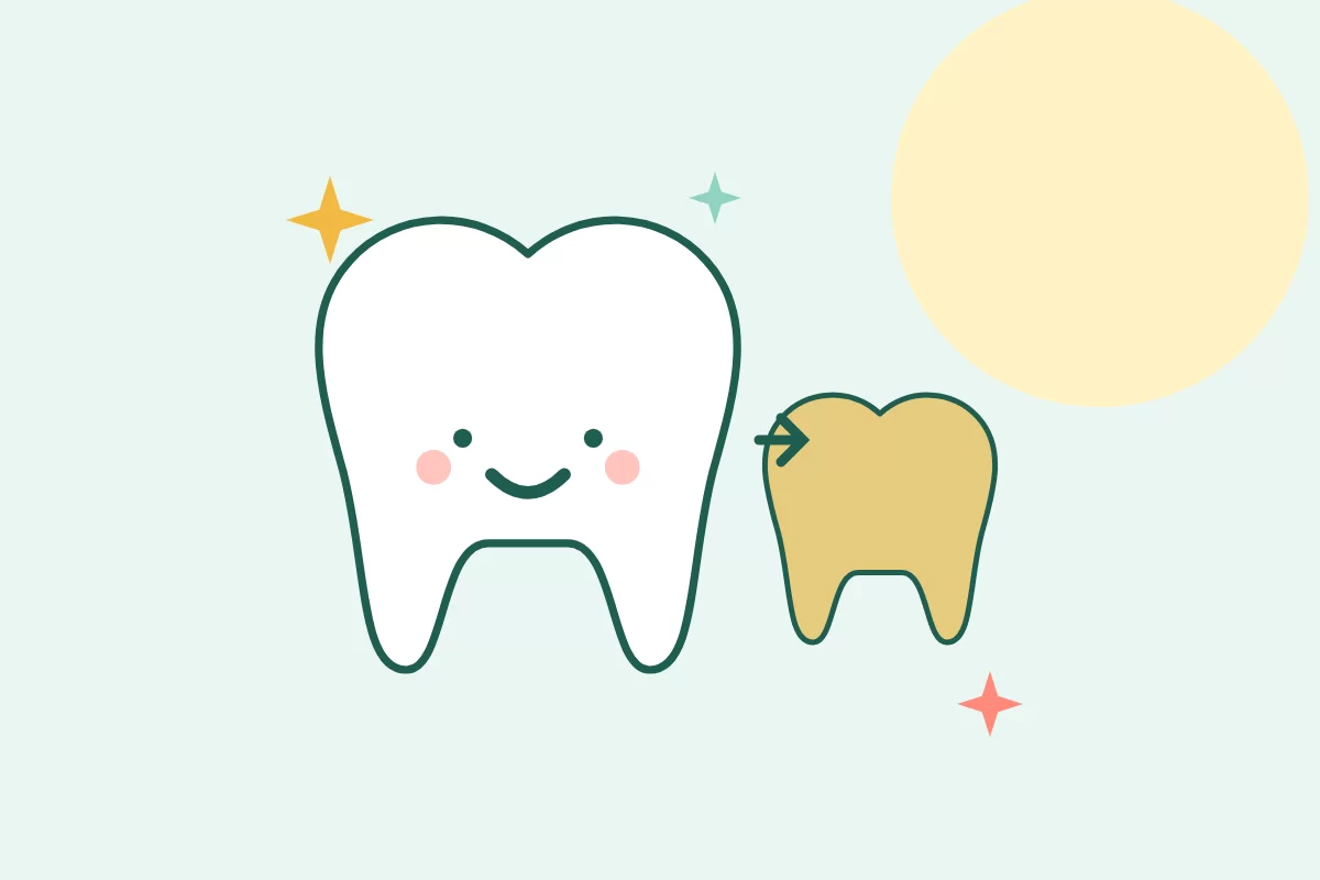 Minh hoạ hai chiếc răng, một chiếc trắng sáng và một chiếc ngả vàng, kèm tia lấp lánh