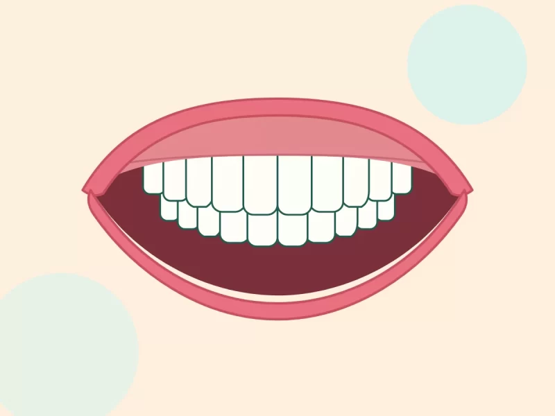 Răng sữa sạch, đã trám sau điều trị (ảnh minh hoạ)