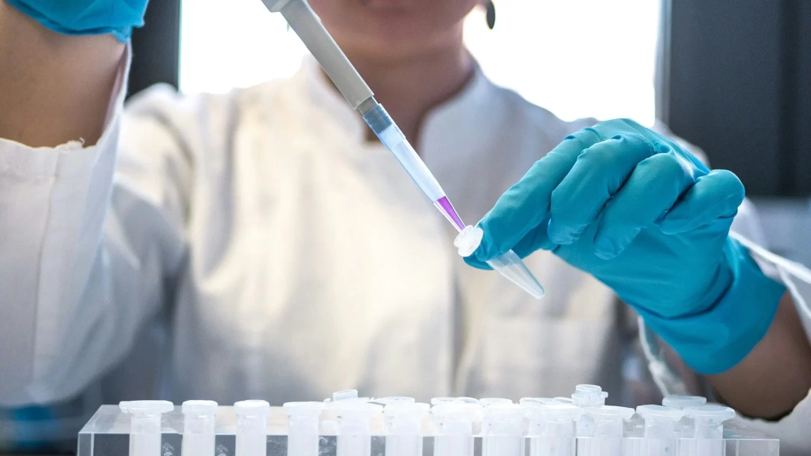 Nhà khoa học dùng pipet nhỏ mẫu vào dãy ống nghiệm trong phòng thí nghiệm