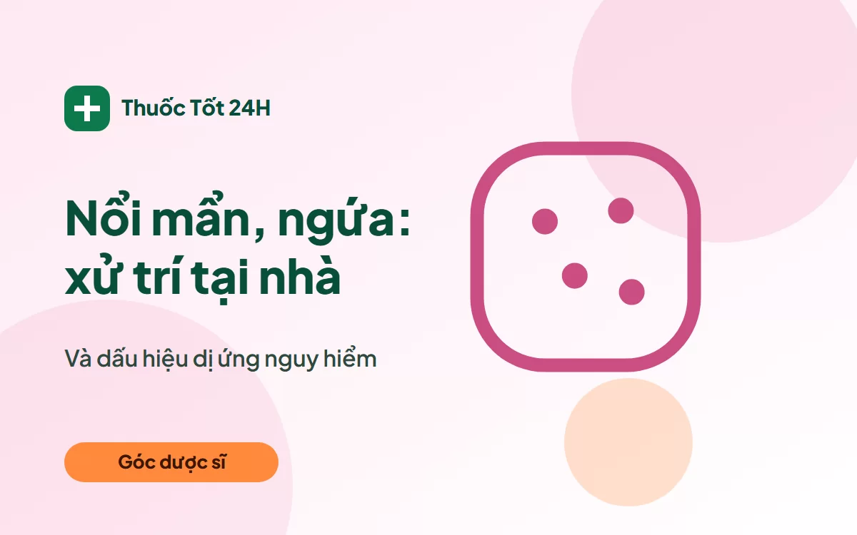 Nổi mẩn ngứa, dị ứng: xử trí tại nhà và cảnh báo nguy hiểm